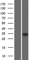 C6orf140 (GLYATL3) Human Over-expression Lysates NM_001010904