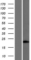 SAM domain containing protein 5 (SAMD5) Human Over-expression Lysates NM_001030060