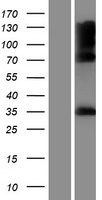 ls389434 iyd human over expression lysates nm 001164694 wb testing 1