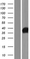 ls389434 iyd human over expression lysates nm 203395 wb testing 2