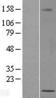 ls389458 rbakdn human over expression lysates nm 203393 wb testing 1