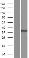 ls389523 gatsl1 human over expression lysates nm 001145063 wb testing 1