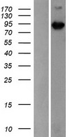 MAP3K15 Human Over-expression Lysates NM_001001671