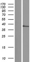 ls390010 nkx1 2 human over expression lysates nm 001146340 wb testing 1
