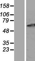 GPR152 Human Over-expression Lysates NM_206997