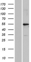 ls390792 keratin 39 krt39 human over expression lysates nm 213656 wb testing 1
