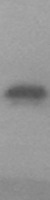 ls390940 pinlyp human over expression lysates nm 001193621 wb testing 1