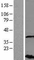 VHLL Human Over-expression Lysates NM_001004319