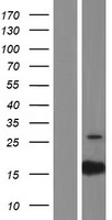 PTRHD1 Human Over-expression Lysates NM_001013663
