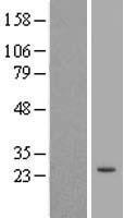 ls391712 trim61 human over expression lysates nm 001012414 wb testing 1