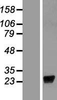 ls392399 lcn9 human over expression lysates nm 001001676 wb testing 1