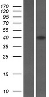 SPRED3 Human Over-expression Lysates NM_001042522