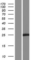 ls399949 hoatz human over expression lysates nm 001100388 wb testing 1