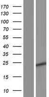 ls399949 hoatz human over expression lysates nm 207430 wb testing 2