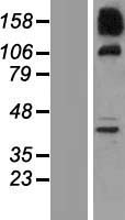 ls399979 snx19 human over expression lysates nm 014758 wb testing 1