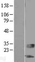ls400120 sertm1 human over expression lysates nm 203451 wb testing 1