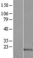 ls400591 c17orf102 human over expression lysates nm 207454 wb testing 1