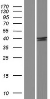 SH2D5 Human Over-expression Lysates NM_001103160
