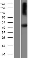 SH2D5 Human Over-expression Lysates NM_001103161