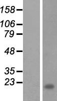 ls401172 linc02145 human over expression lysates nm 001001702 wb testing 1