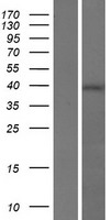 RGS7BP Human Over-expression Lysates NM_001029875