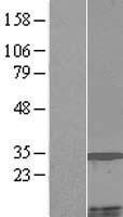 ls401250 mccd1 human over expression lysates nm 001011700 wb testing 1
