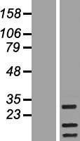 RAB19B (RAB19) Human Over-expression Lysates NM_001008749