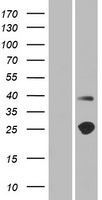 TMEM215 Human Over-expression Lysates NM_212558