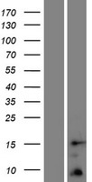 ls401505 tomm5 human over expression lysates nm 001134484 wb testing 1