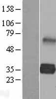 ls401944 ldlrad2 human over expression lysates nm 001013693 wb testing 1