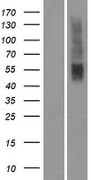 ls401993 or2t5 human over expression lysates nm 001004697 wb testing 1
