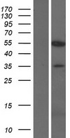 KPNA7 Human Over-expression Lysates NM_001145715