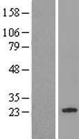 C7orf61 Human Over-expression Lysates NM_001004323
