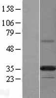 PLPP6 Human Over-expression Lysates NM_203453