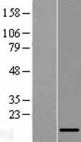 LINC01561 Human Over-expression Lysates NM_001012711