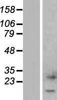 CTXN1 Human Over-expression Lysates NM_206833