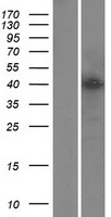 ls404281 yy2 human over expression lysates nm 206923 wb testing 1