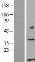 TTDA (GTF2H5) Human Over-expression Lysates NM_207118