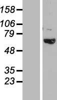 TBC1D3B Human Over-expression Lysates NM_001001417
