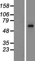 TBC1D3C Human Over-expression Lysates NM_001001418