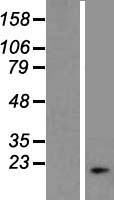HCG3 (DNAJB3) Human Over-expression Lysates NM_001001394