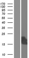 C10orf105 Human Over-expression Lysates NM_001168390