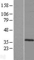 C10orf62 Human Over-expression Lysates NM_001009997