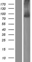 AGAP6 Human Over-expression Lysates NM_001077665