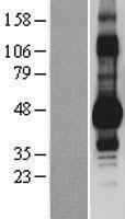 DDI1 Human Over-expression Lysates NM_001001711
