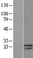 LCN10 Human Over-expression Lysates NM_001001712