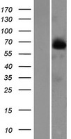FAM116B (DENND6B) Human Over-expression Lysates NM_001001794