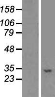 STX19 Human Over-expression Lysates NM_001001850