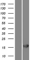 ls431704 rgs21 human over expression lysates nm 001039152 wb testing 1