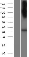 ls440044 slc22a20p human over expression lysates nm 001004326 wb testing 1